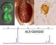 A role for the polyQ protein ataxin 2 in ALS was identified using yeast (top left), fruit fly models (top middle), human ALS motor neurons (top right) and genetic analysis in ALS patients (bottom).